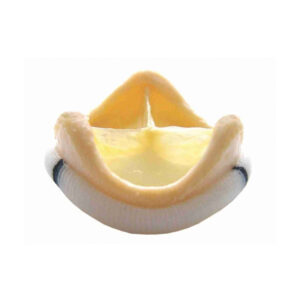 Válvula Aórtica Biológica Porcina